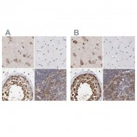 Anti-CCT2 antibody produced in rabbit 
