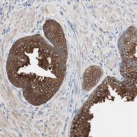 Anti-CCT3 antibody produced in rabbit HPA006543-100UL