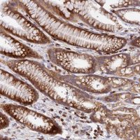 Anti-CCT6A antibody produced in rabbit HPA042996-100UL