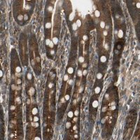 Anti-CCT7 antibody produced in rabbit 