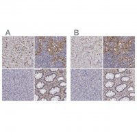 Anti-CD14 antibody produced in rabbit 