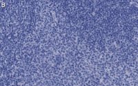 Anti-CD25 (IL2-RA) Antibody, clone 1K6 ZooMAb Rabbit Monoclonal 