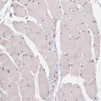 Anti-CD2BP2 antibody produced in rabbit 