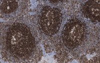 Anti-CD45 Antibody, clone 5L3, ZooMAb Rabbit Monoclonal 