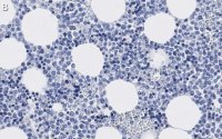 Anti-CD63 Antibody, clone 3H6 ZooMAb Rabbit Monoclonal 