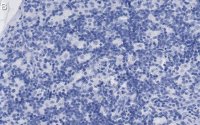 Anti-CD8 Antibody, clone 1H21 ZooMAb Rabbit Monoclonal 