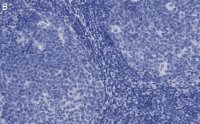 Anti-CD81 Antibody, clone 1C23 ZooMAb Rabbit Monoclonal 