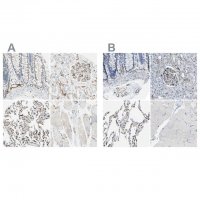 Anti-CD93 antibody produced in rabbit 