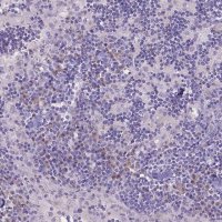 Anti-CD96 antibody produced in rabbit 