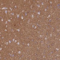 Anti-CD99L2 antibody produced in rabbit HPA038782-100UL