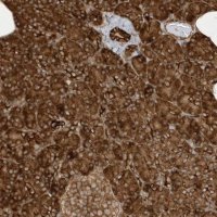 Anti-CDC42EP3 antibody produced in rabbit 