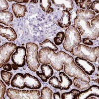 Anti-CDH16 antibody produced in rabbit 