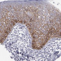 Anti-CDH3 antibody produced in rabbit 
