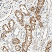 Anti-CDH6 antibody produced in rabbit 
