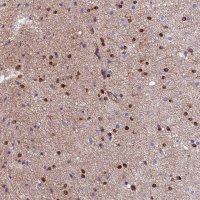 Anti-CDK18 antibody produced in rabbit HPA045429-100UL