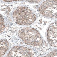 Anti-CDK20 antibody produced in rabbit 