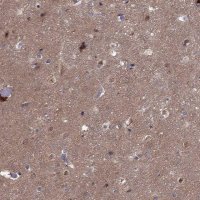 Anti-CDK5 antibody produced in rabbit 