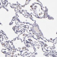 Anti-CDKL5 antibody produced in rabbit HPA002847-100UL