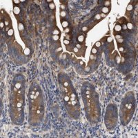 Anti-CDKN2C antibody produced in rabbit 