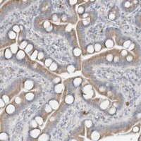 Anti-CDS1 antibody produced in rabbit 