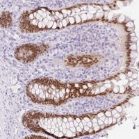 Anti-CDX1 antibody produced in rabbit 