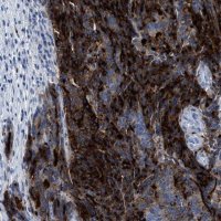 Anti-CEACAM5 antibody produced in rabbit 