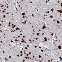 Anti-CELF2 antibody produced in rabbit 