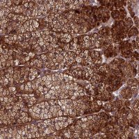 Anti-CENPL antibody produced in rabbit 