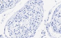 Anti-Centrin Antibody, clone 20H5 ZooMAb Mouse Monoclonal 