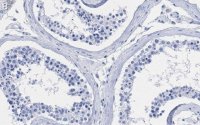 Anti-Centrin-1 Antibody, clone 5L17 ZooMAb Rabbit Monoclonal 