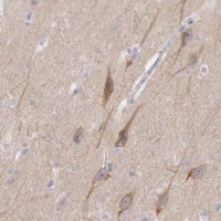Anti-CEP170B antibody produced in rabbit 
