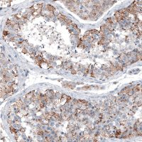 Anti-CEP192 antibody produced in rabbit 
