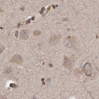 Anti-CEP350 antibody produced in rabbit 