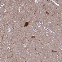 Anti-CEP41 antibody produced in rabbit 