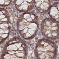 Anti-CEP70 antibody produced in rabbit 