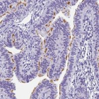 Anti-CFAP100 antibody produced in rabbit 