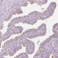 Anti-CFAP126 antibody produced in rabbit 