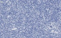 Anti-CFTR Antibody, clone 1C22 ZooMAb Rabbit Monoclonal 