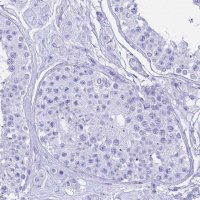 Anti-CGB3 antibody produced in rabbit 