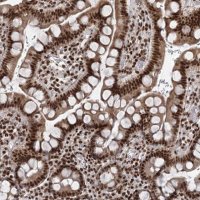 Anti-CGGBP1 antibody produced in rabbit 
