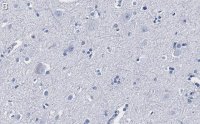 Anti-CGRP-1 Antibody, clone 2E18 ZooMAb Rabbit Monoclonal 