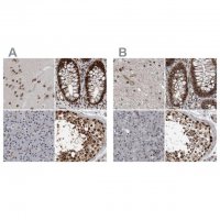 Anti-CHD1L antibody produced in rabbit 
