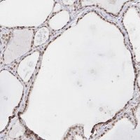Anti-CHD2 antibody produced in rabbit 