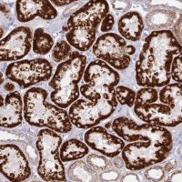 Anti-CHDH antibody produced in rabbit 