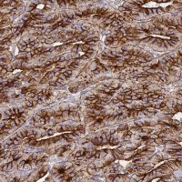 Anti-CHGA antibody produced in rabbit 