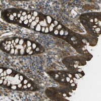Anti-CHMP3 antibody produced in rabbit 