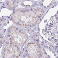 Anti-CHMP5 antibody produced in rabbit 