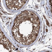 Anti-CHMP6 antibody produced in rabbit 