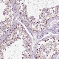 Anti-CHODL antibody produced in rabbit 