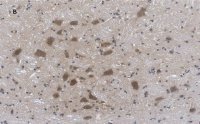 Anti-Choline Acetyltransferase (ChAT) Antibody, clone 2K16, ZooMAb Rabbit Monoclonal 